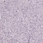 Immunohistochemical staining of human liver shows no cytoplasmic positivity in hepatocytes as expected.