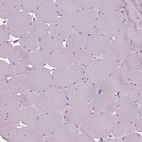 Immunohistochemical staining of human skeletal muscle shows no cytoplasmic positivity in myocytes as expected.