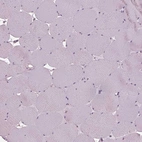 Immunohistochemical staining of human skeletal muscle shows no cytoplasmic positivity in myocytes as expected.