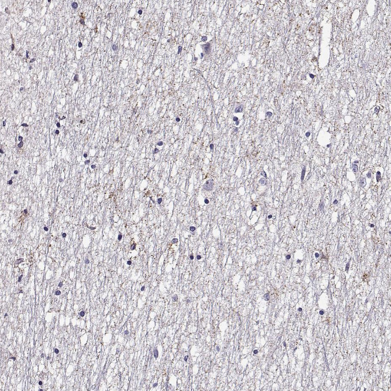 Anti-FEZF1 Antibody