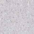Anti-FEZF1 Antibody