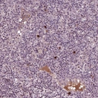 Anti-PTX4 Antibody