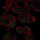 Anti-SOX18 Antibody