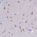 Immunohistochemical staining of human cerebral cortex shows moderate to strong nuclear positivity in neurons.