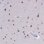 Immunohistochemical staining of human cerebral cortex shows moderate to strong nuclear positivity in neurons.