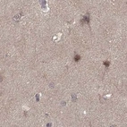 Immunohistochemical staining of human cerebral cortex using Anti-PLEKHG3 antibody HPA073702.