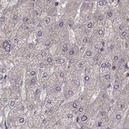 Immunohistochemical staining of human liver using Anti-PLEKHG3 antibody HPA073702.