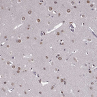 Immunohistochemical staining of human cerebral cortex shows strong positivity in nuclear membrane in neurons.