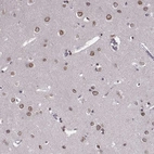 Immunohistochemical staining of human cerebral cortex shows strong positivity in nuclear membrane in neurons.