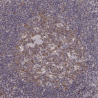 Immunohistochemical staining of human tonsil shows strong positivity in nuclear membrane in germinal center cells.