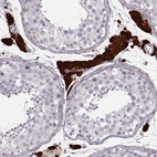 Anti-ZNF433 Antibody