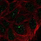 Immunofluorescent staining of human cell line RT4 shows localization to nuclear bodies.