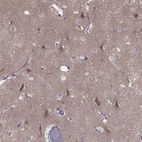 Immunohistochemical staining of human cerebral cortex shows high expression.