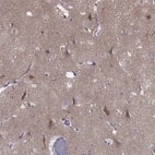 Immunohistochemical staining of human cerebral cortex shows high expression.