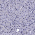 Immunohistochemical staining of human pancreas shows low expression as expected.