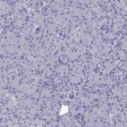 Immunohistochemical staining of human pancreas shows low expression as expected.