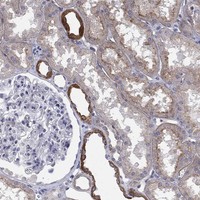 Anti-TINAG Antibody