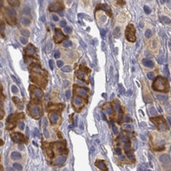 Anti-TIGD4 Antibody