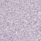 Immunohistochemical staining of human liver shows no positivity in hepatocytes as expected.
