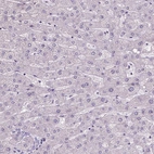 Immunohistochemical staining of human liver shows no positivity in hepatocytes as expected.