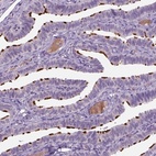Anti-MDH1B Antibody