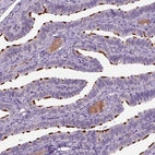 Anti-MDH1B Antibody