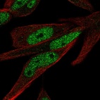 Anti-ZNF225 Antibody