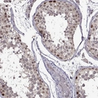 Anti-CHFR Antibody