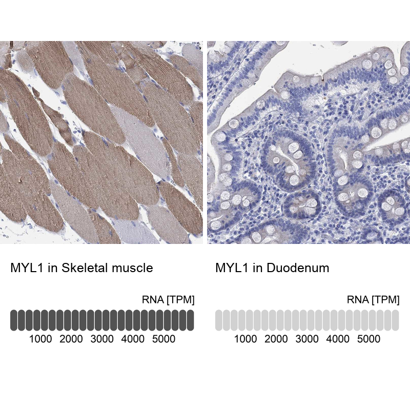 Anti-MYL1 Antibody