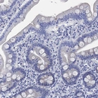 Immunohistochemical staining of human duodenum shows low expression as expected.