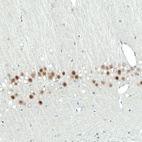 Anti-SATB2 Antibody