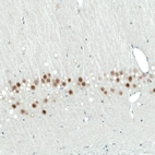 Immunohistochemical staining of rat hippocampus shows moderate nuclear positivity in neurons in the CA1 layer.