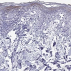 Immunohistochemical staining of human skin shows high expression.