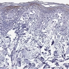 Immunohistochemical staining of human skin shows high expression.