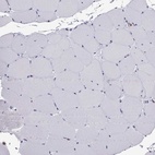 Immunohistochemical staining of human skeletal muscle shows low expression as expected.