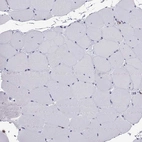 Immunohistochemical staining of human skeletal muscle shows low expression as expected.