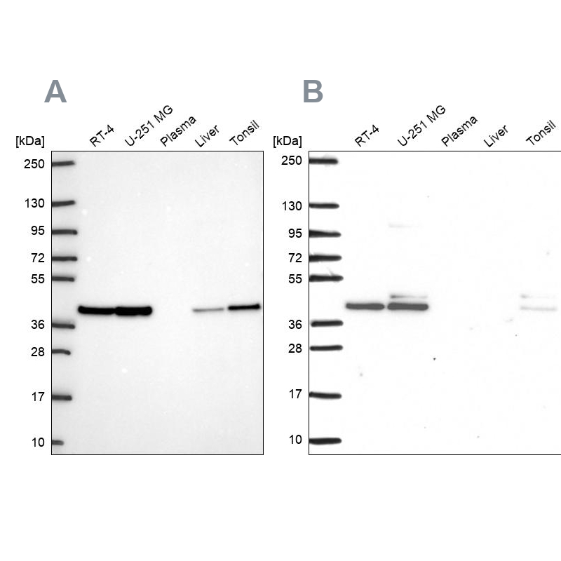 Anti-STRAP Antibody