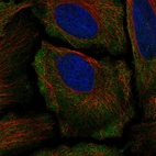 Anti-GRIK1 Antibody