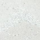 Immunohistochemical staining of rat hippocampus shows no nuclear positivity in neurons in the dentate gyrus as expected.