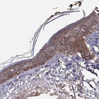 Immunohistochemical staining of human skin shows high expression.