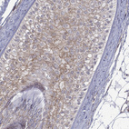 Immunohistochemical staining of human hair shows moderate membranous positivity in external root.