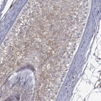 Immunohistochemical staining of human hair shows moderate membranous positivity in external root.