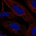 Anti-LMNTD2 Antibody