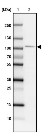 Lane 1: Marker [kDa]_br/_Lane 2: Human cell line HEL