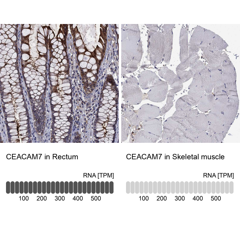 Anti-CEACAM7 Antibody