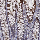 Immunohistochemical staining of human rectum shows strong membranous and cytoplasmic positivity in glandular cells.