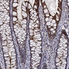 Immunohistochemical staining of human rectum shows strong membranous and cytoplasmic positivity in glandular cells.