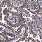 Immunohistochemical staining of human duodenum shows strong membranous and cytoplasmic positivity in glandular cells.