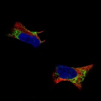Anti-PTN Antibody