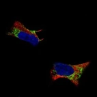 Anti-PTN Antibody